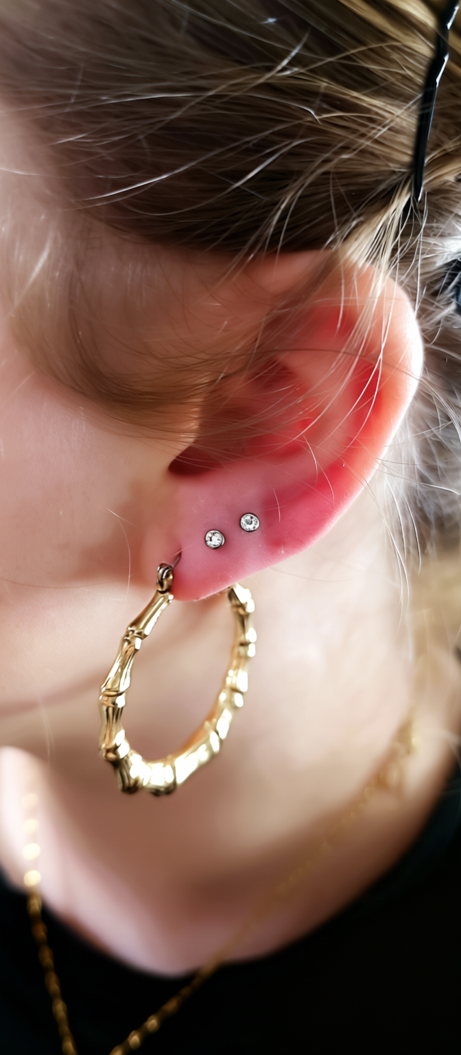 Lobe